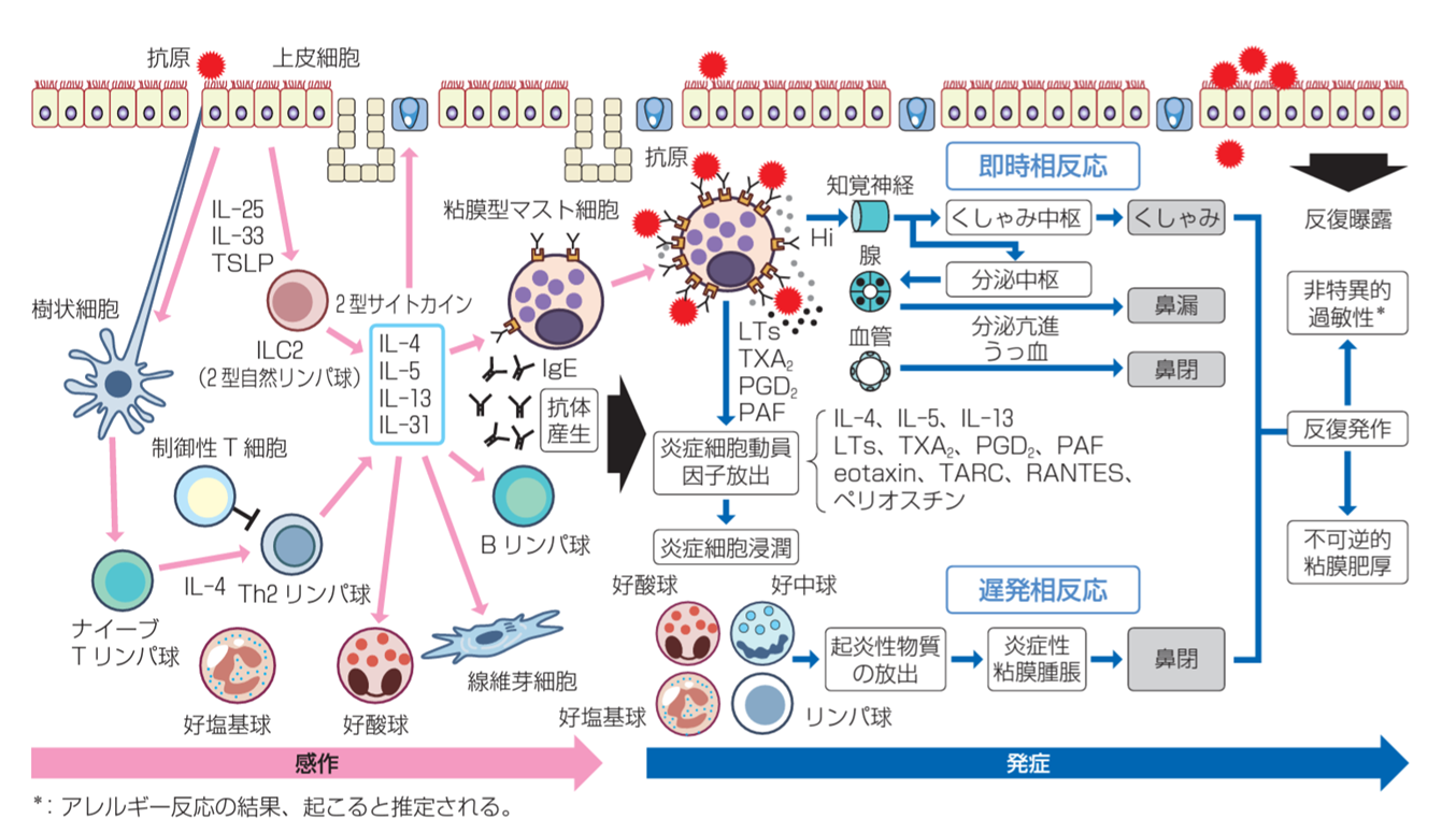 アレルギー性鼻炎について | 岩沼市土ヶ崎の内科・呼吸器内科 