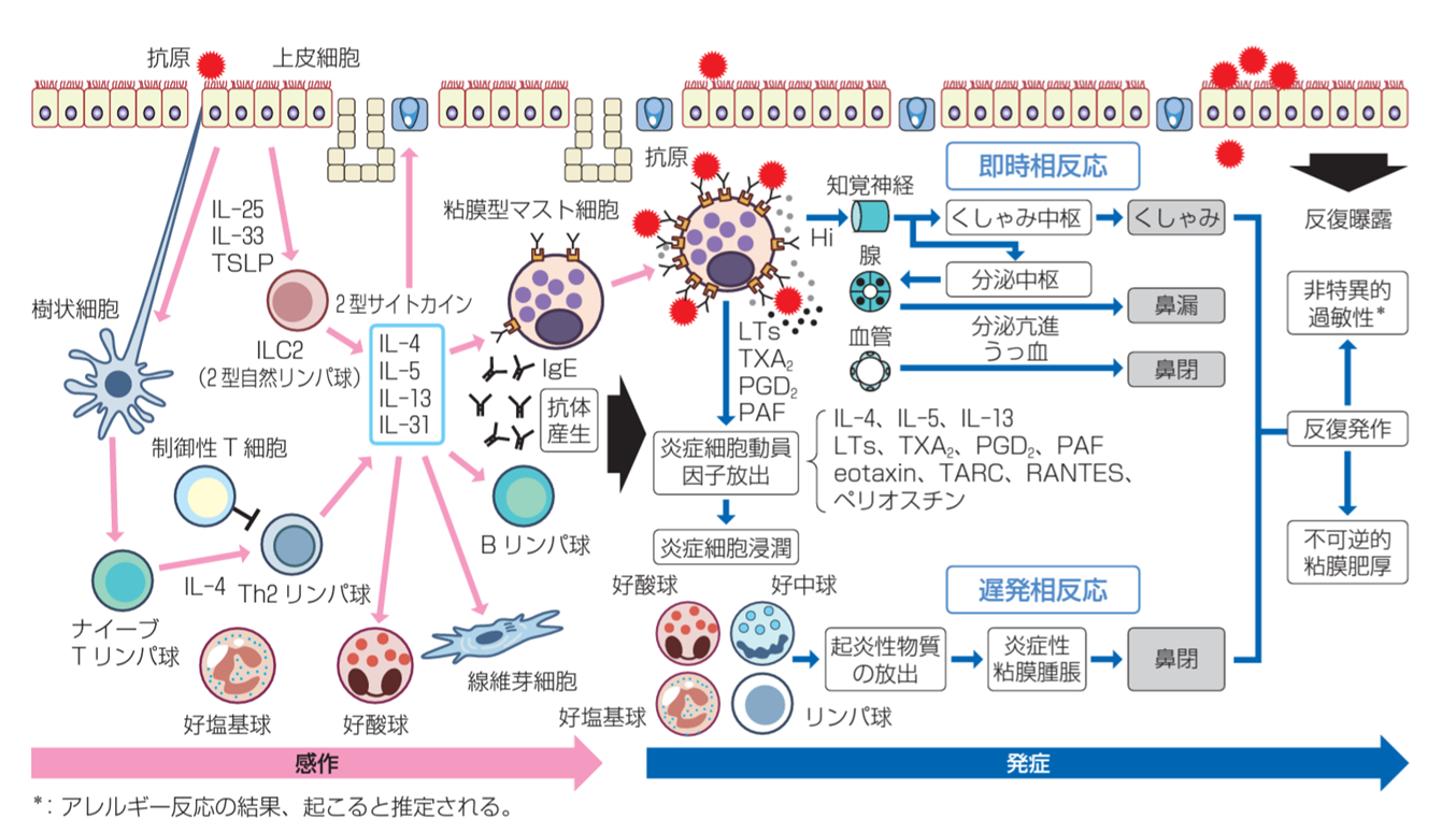 アレルギー性鼻炎の症状